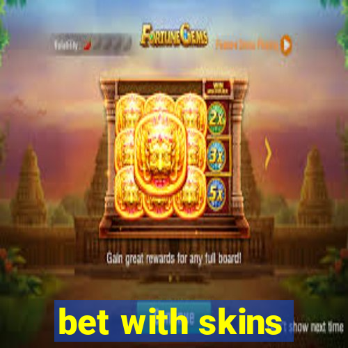 bet with skins