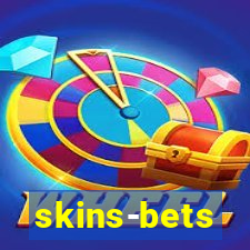 skins-bets