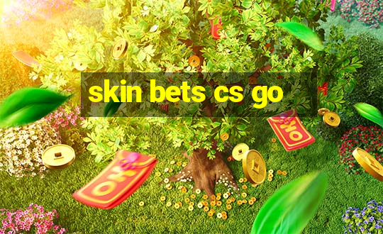 skin bets cs go