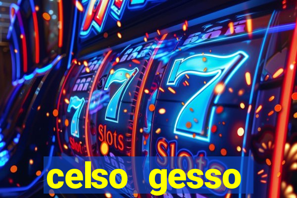 celso gesso cruzeiro sp