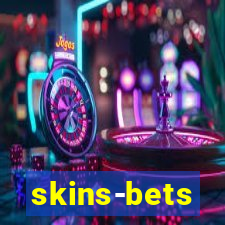 skins-bets