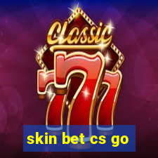 skin bet cs go